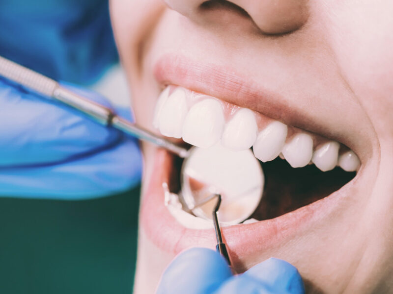 Conoce el novedoso descubrimiento que puede reemplazar el cepillado de los dientes (+Detalles)
