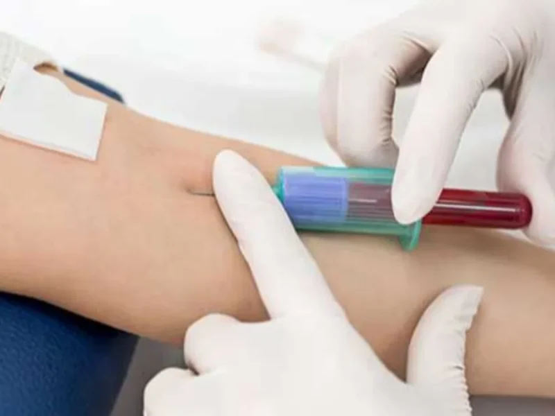 Universidad estadounidense logra detección temprana del cáncer: nueva prueba de sangre anticipa recaídas