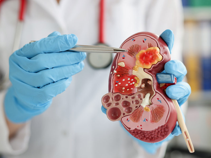 La «pandemia silenciosa» que alerta a los especialistas